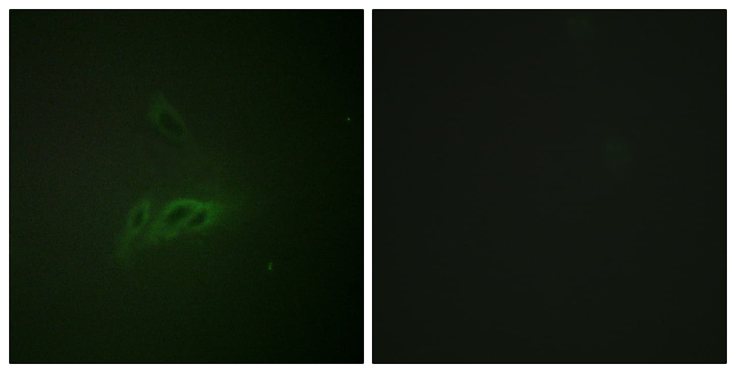 CD45 / LCA Antibody (phospho-Ser1007)