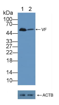 Polyclonal Rabbit anti-Human NAMPT / Visfatin Antibody (aa1-491, WB)