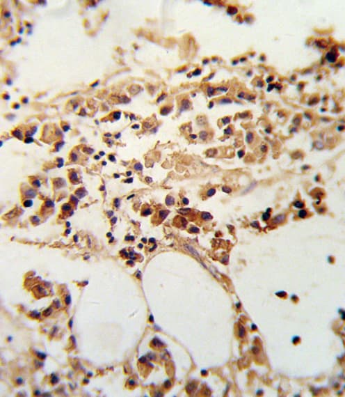 Polyclonal Rabbit anti-Human TIMP3 Antibody (aa113-139, IHC, WB)