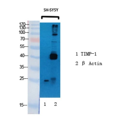Polyclonal Rabbit anti-Human TIMP1 Antibody (30-110 aa, Internal, WB)