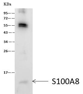 S100A8 / MRP8 Antibody (clone 203, Preservative Free)