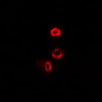Polyclonal Rabbit anti-Human OGDH Antibody (IF, WB)