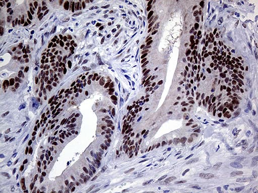 Monoclonal Mouse anti-Human MLH1 Antibody (clone OTI3C1, Carrier-free, aa299-527, IHC, WB)