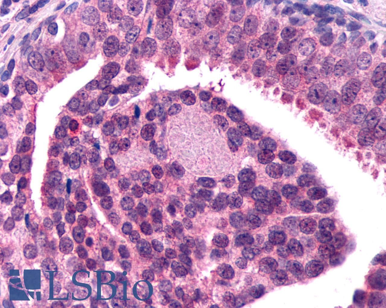 PathPlus™ Polyclonal Rabbit anti-Human F2RL1 / PAR2 Antibody (C-Terminus, IHC)