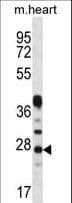 CRYBA1 Antibody (aa104-133)