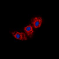 CDH23 / Cadherin 23 Antibody (aa86-125)