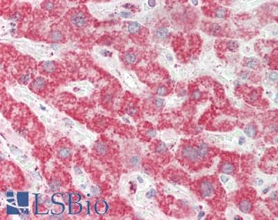 IHC-plus™ Polyclonal Rabbit anti-Human CHI3L1 / YKL-40 Antibody (IHC, WB)