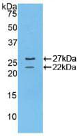 FBN1 / Fibrillin 1 Antibody (aa1701-1887)
