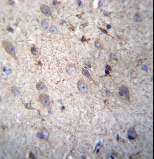 GSTM5-5 / GSTM5 Antibody (aa14-43)