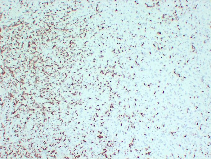 ZAP70 Antibody (clone ABT-ZAP70)