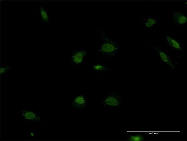 Monoclonal Mouse anti-Human POLR2F Antibody (clone 2G2, IF, WB)