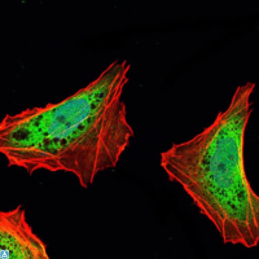 Monoclonal Mouse anti-Human ATXN1 / SCA1 Antibody (IHC, IF, WB)