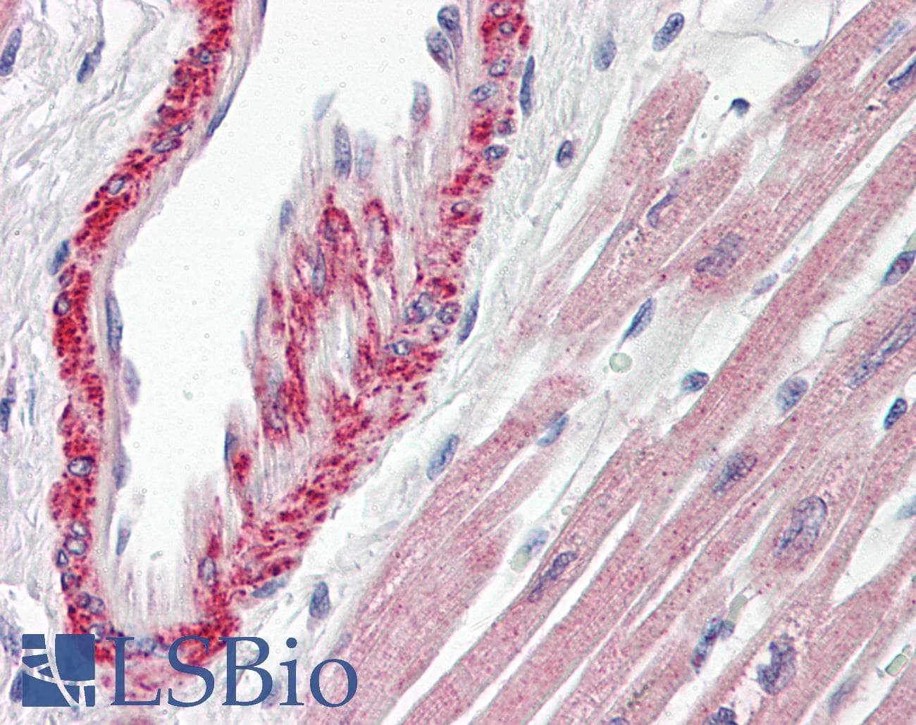 IHC-plus™ Polyclonal Rabbit anti-Human AP1S2 Antibody (IHC, WB)