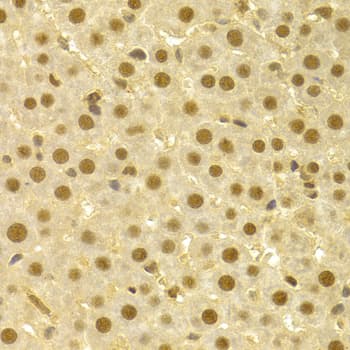 CDC25A Antibody