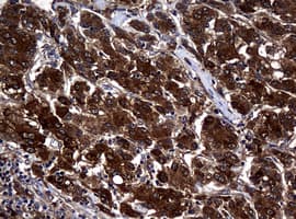 NME1 / NM23 Antibody (clone OTI4G3, Carrier-free)