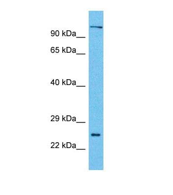 Polyclonal Rabbit anti-Human SKP2 Antibody (C-Terminus, WB)