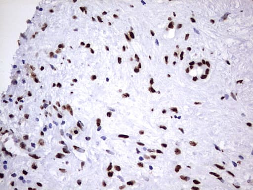 HNRPM / HNRNPM Antibody (aa1-261, clone OTI4C9)