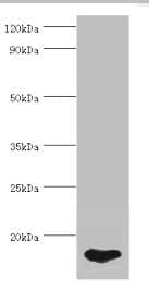 E-FABP / FABP5 Antibody (aa1-135)