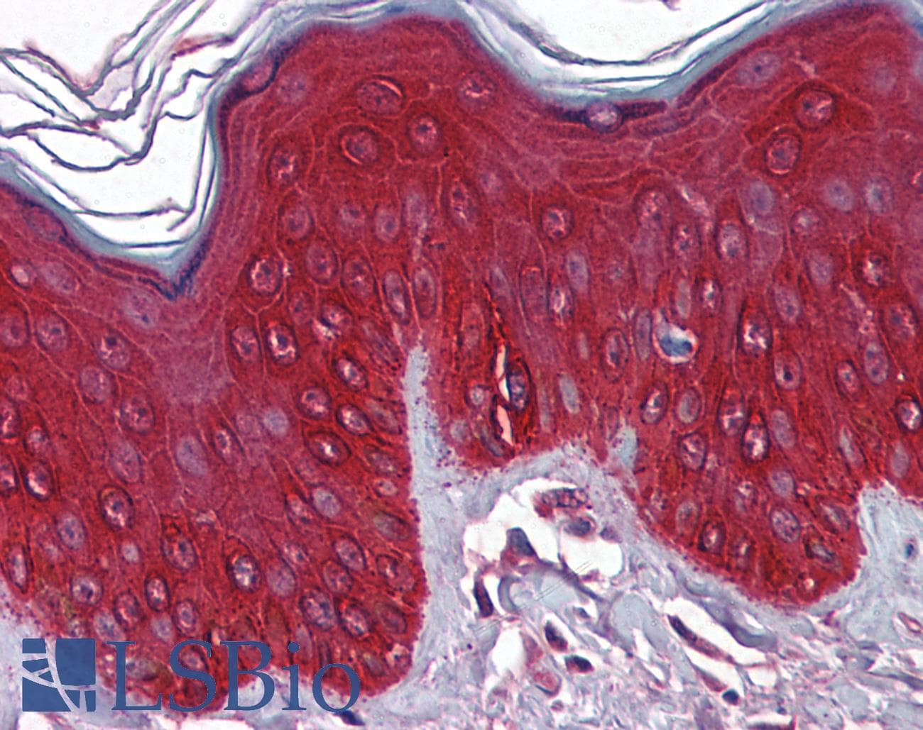 IHC-plus™ KRT17 / CK17 / Cytokeratin 17 Antibody (clone 2D4-1G9)