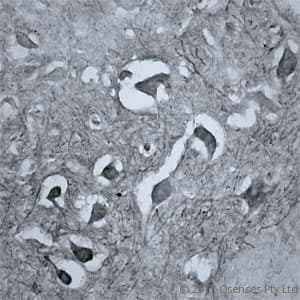 RHOA Antibody (aa100-150)