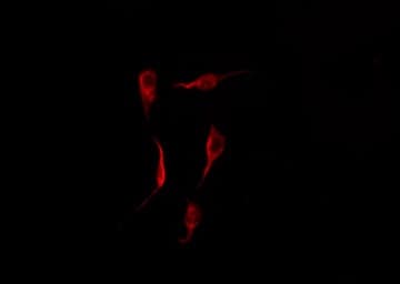 S100P Antibody