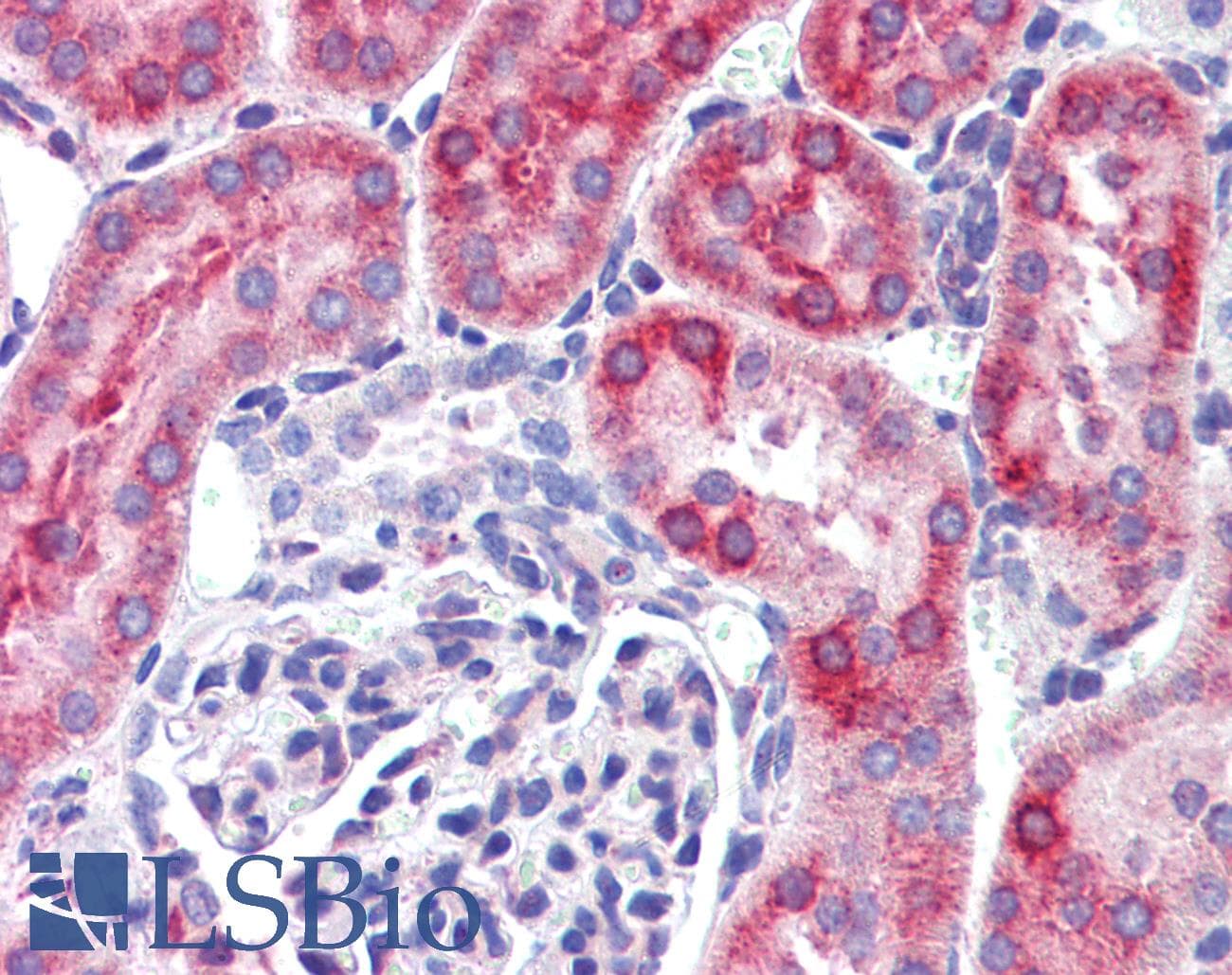 IHC-plus™ IFIH1 / MDA5 Antibody