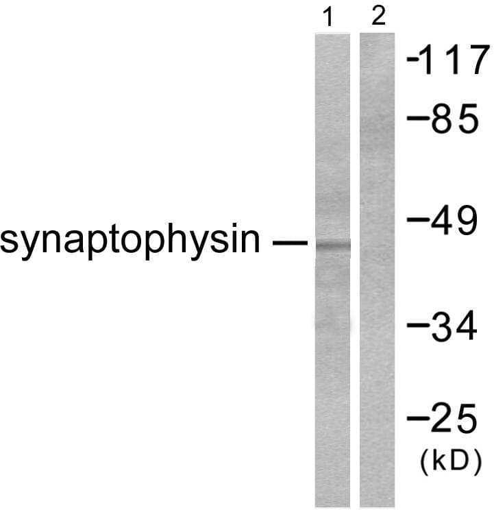 Polyclonal Rabbit anti-Human SYP / Synaptophysin Antibody (aa101-150, IHC, WB)