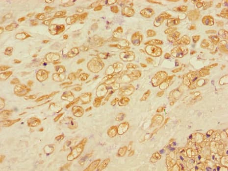 Polyclonal Rabbit anti-Human RBBP8 / CTIP Antibody (IHC)