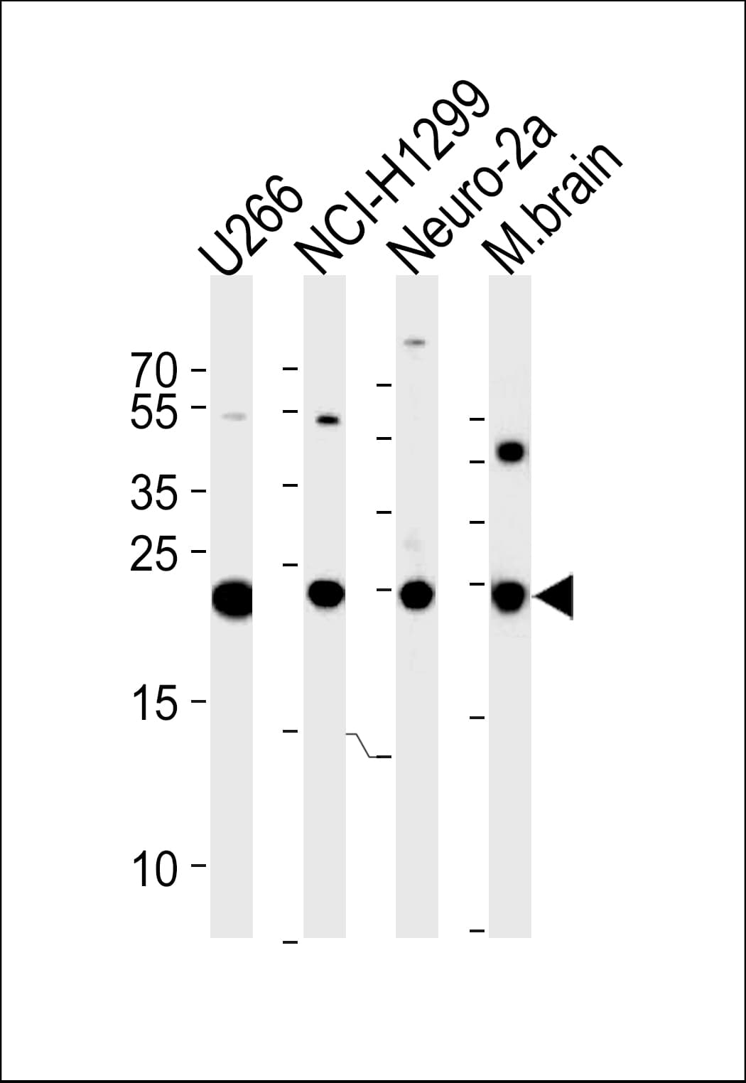 IHC-plus™ UCHL1 / PGP9.5 Antibody (aa187-214)