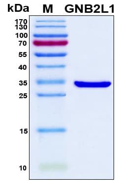 Human GNB2L1 / RACK1 Protein (Recombinant 6His, N-terminus)