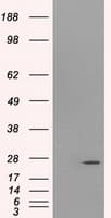 Monoclonal Mouse anti-Human PSMD10 / Gankyrin Antibody (clone OTI3F6, WB)