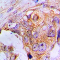 APAF1 / APAF-1 Antibody (C-Terminus)