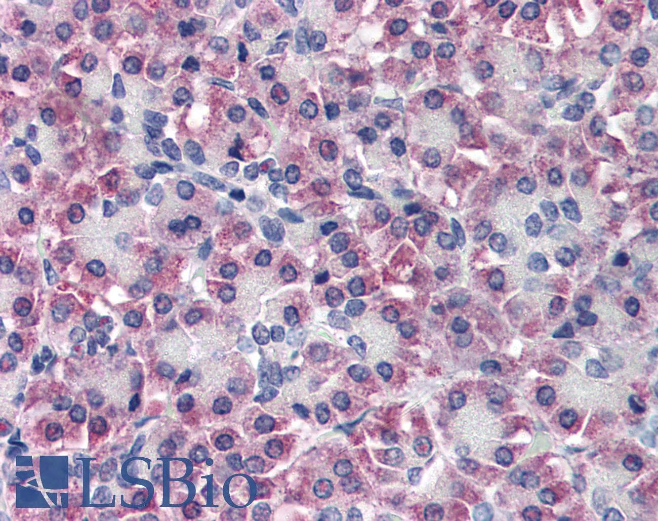 IHC-plus™ TTR / Transthyretin Antibody (aa89-100)