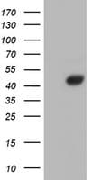 AHSG / Fetuin A Antibody (clone OTI2H2)