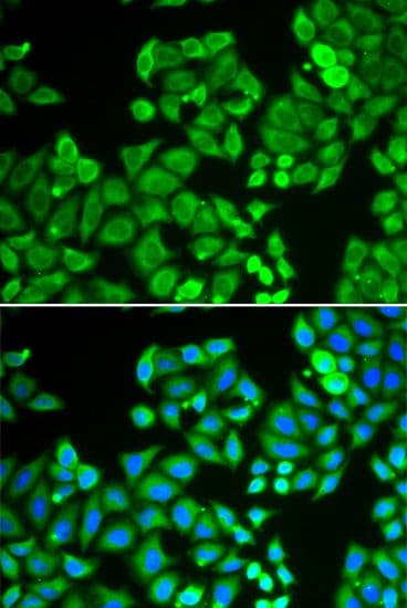 Polyclonal Rabbit anti-Human PPP4C Antibody (IF, WB)