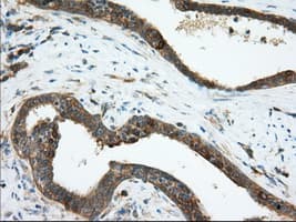 ERIC-1 / TACC3 Antibody (clone OTI1E4)