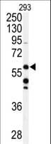 ADCK3 / CABC1 Antibody (aa516-545)