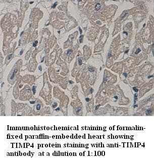 TIMP4 Antibody (C-Terminus)