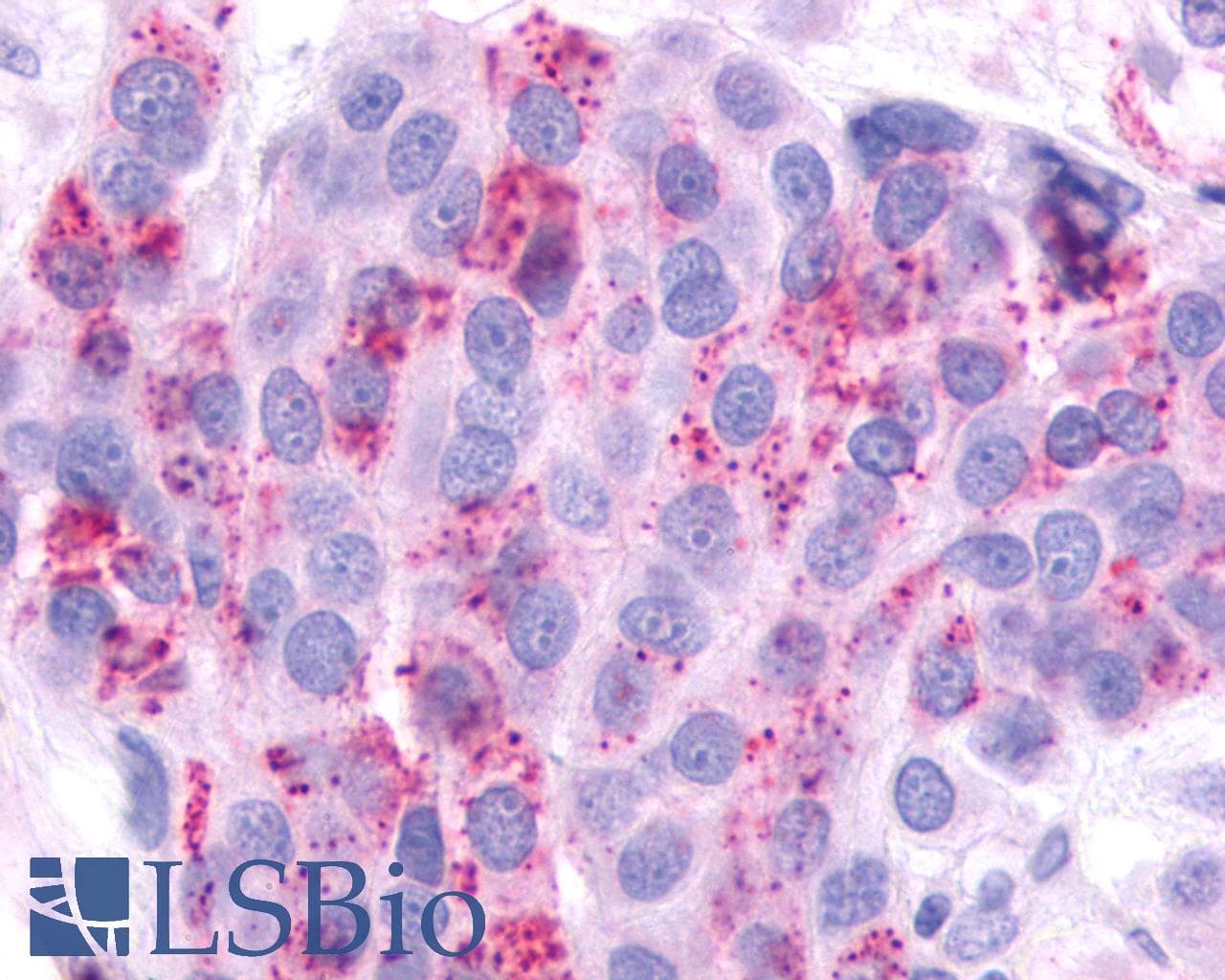 PathPlus™ AVPR2 / V2R Antibody (C-Terminus)
