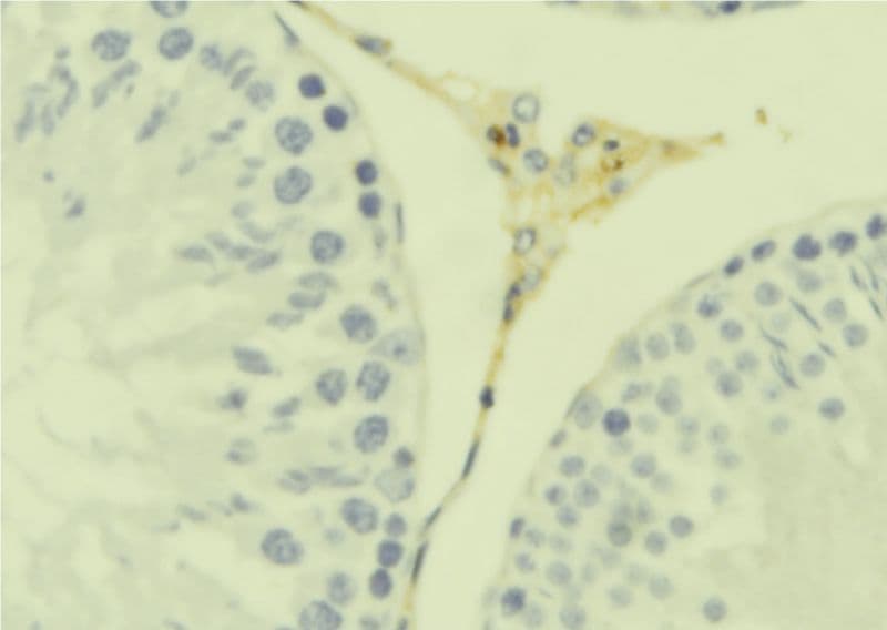 CKLF Antibody