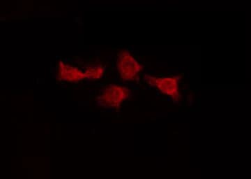 Polyclonal Rabbit anti-Human CFL2 / Cofilin 2 Antibody (IF, WB)