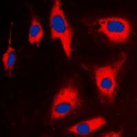 TPT1 / TCTP Antibody (Internal)