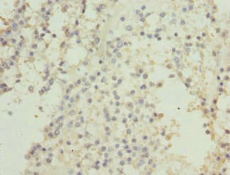 Polyclonal Rabbit anti-Human CSNK1G2 / CKI-Gamma 2 Antibody (IHC, WB)