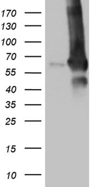 GDI1 Antibody (clone OTI1B1)