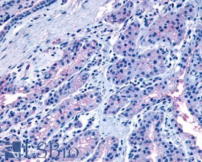 PathPlus™ Polyclonal Rabbit anti-Human OXTR / Oxytocin Receptor Antibody (Cytoplasmic Domain, IHC)