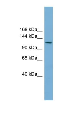 Polyclonal Rabbit anti-Human CDC27 Antibody (aa395-444, WB)