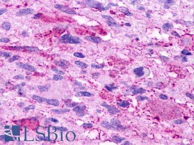 PathPlus™ GPR84 Antibody (Transmembrane Domain)
