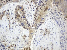 TP / Thymidine Phosphorylase Antibody (clone OTI7B4)