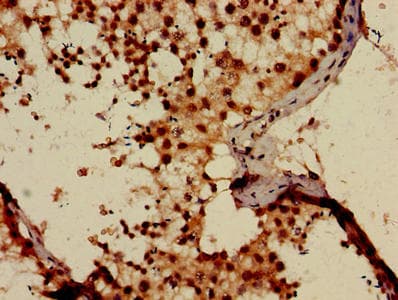 PGM1 / Phosphoglucomutase 1 Antibody (aa1-562)