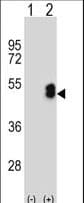 Polyclonal Rabbit anti-Human LMX1B Antibody (aa175-202, IHC, WB)